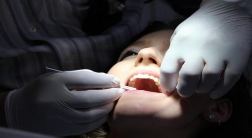 How Teeth Can Get Discolored and What Dentists Do to Whiten Them
