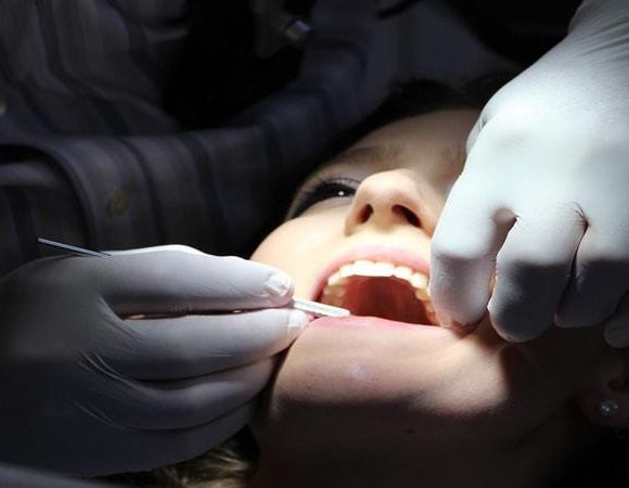 How Teeth Can Get Discolored and What Dentists Do to Whiten Them